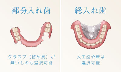 部分入れ歯…クラスプ（留め具）が無いものも選択可能　総入れ歯…人工歯や床は選択可能