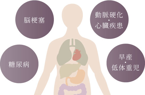 脳梗塞、糖尿病、動脈硬化・心臓疾患、早産・低体重児